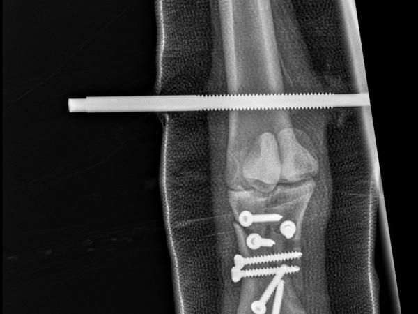 Nora-25