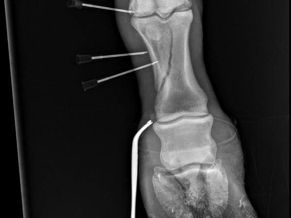 Nora-40
